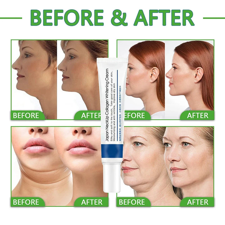 Collagen Neck Cream